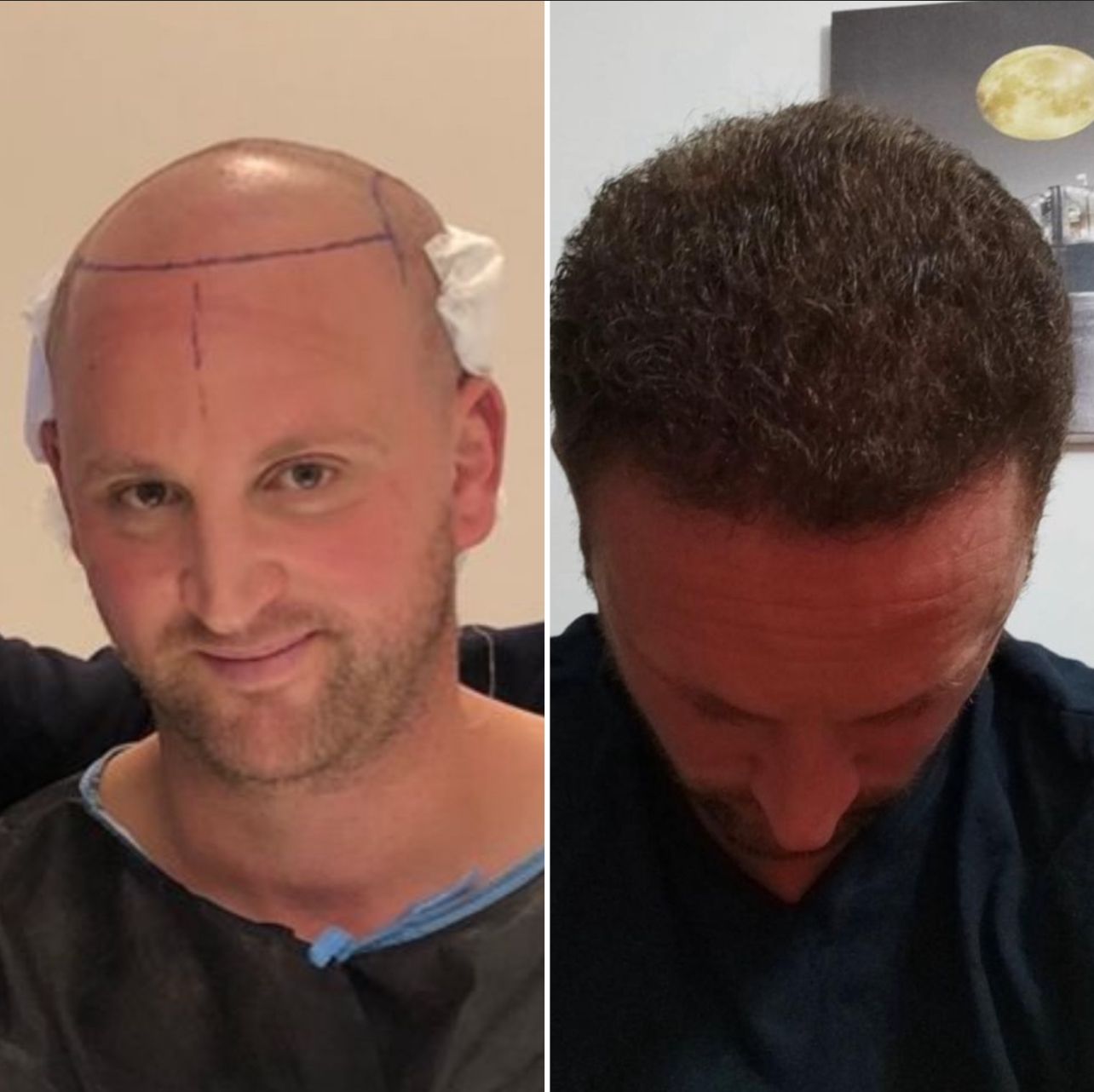 דורון שמעוני